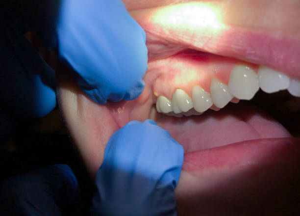 Best Broken or Chipped Tooth Repair in Woodway, TX
